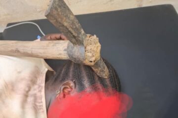 Une patiente victime d'une attaque violente avec une pioche opérée avec succès au CHUR de Ouahigouya, 22 mai 2025